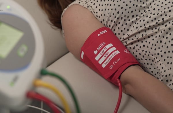 doppler αγγείων 