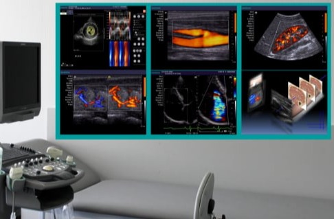 διαγνωστικές εξετάσεις αρτηρίων