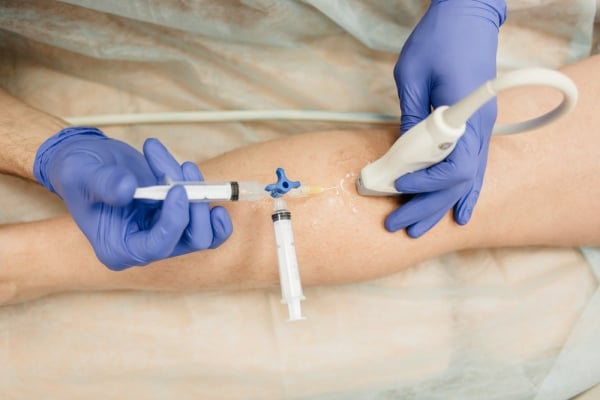 μκροσκληροθεραπεία